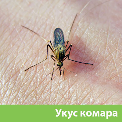 Укусы комаров в Нижнем Новгороде
